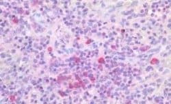 PIM1 Antibody, Novus Biologicals 50 &mu;g | Buy Online | Novus Biologicals | Fisher Scientific